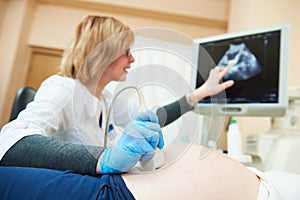 Ultrasound test. Pregnancy. Gynecologist checking fetal life with scanner.