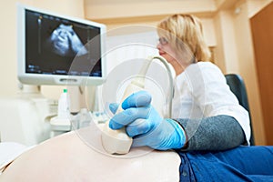 Ultrasound test. Pregnancy. Gynecologist checking fetal life with scanner.