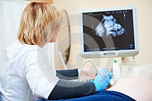 Ultrasound test. Pregnancy. Gynecologist checking fetal life with scanner.