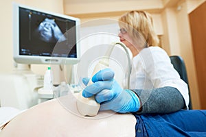Ultrasound test. Pregnancy. Gynecologist checking fetal life with scanner. photo