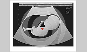 Ultrasound of unborn baby in mother`s womb, medical concept, vector illustration.