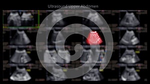 Ultrazvuk horní břicho zobrazené játra a žluč měchýř promítání buňka a 