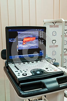 Ultrasound of the veins of the lower extremities