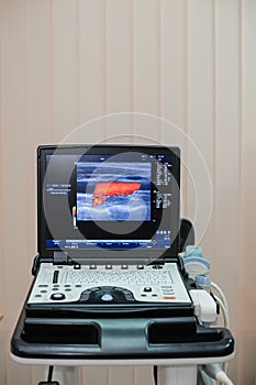 Ultrasound of the veins of the lower extremities