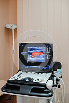 Ultrasound of the veins of the lower extremities photo