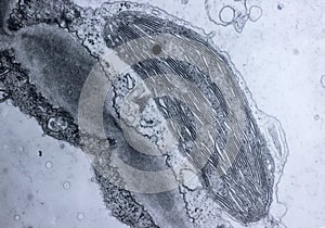 A ultrathin section of tobacco leaf mesophyll cells showing chloroplast structure