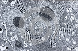 A ultrathin section of vegetal leaf mesophyll cells showing chloroplast structure