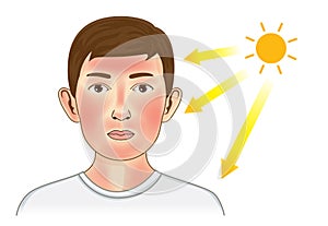 Ultraviolet ray from sun make the redness appear on boy facial and neck skin.