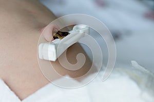 Umbilical cord with clamp of newborn baby close-up