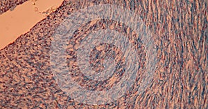 Umbilical cord in cross section