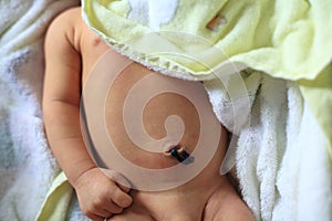 umbilical cord of newborn baby