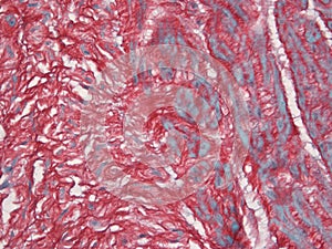 Umbilical Cord Stained with Picrosirius Red