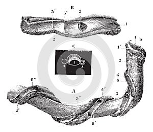 Umbilical cord, vintage engraving