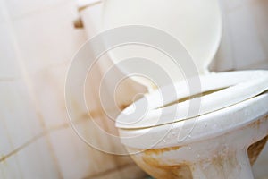Unclean dirty old toilet bowl in the bathroom. Is a collection of germs disease bacteria. photo