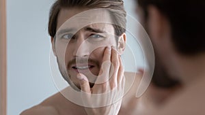 Unhappy man feeling stressed of sensitive skin or acne breakout.