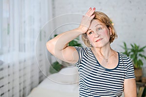 Unhappy mature woman touching her head while feeling severe headache while