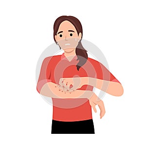 Unhappy suffering woman scratching the skin on her hand. Various skin problems, such as allergies, psoriasis, itching, atopic