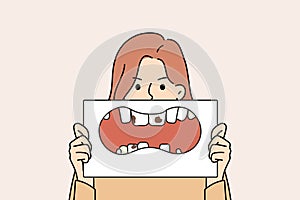 Unhappy woman showing teeth decay