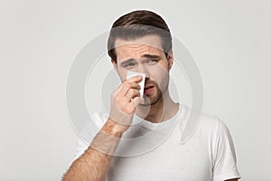 Unhappy young man use paper tissue feeling unwell