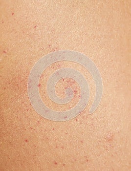 unhealthy human skin texture covered with red spots of irritation