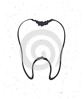 Unhealthy human tooth with caries. Outline. Vector illustration. Symbol of somatology and oral hygiene. Hand drawn sketch.