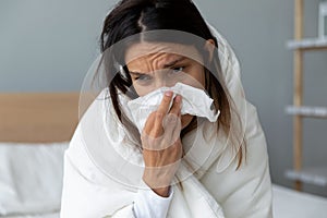 Unhealthy millennial mixed race girl wiping runny nose.