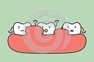 Unhealthy teeth because gingivitis or gum disease with abscess, gum is swollen
