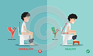 Unhealthy vs healthy positions for defecate