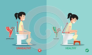 Unhealthy vs healthy positions for defecate