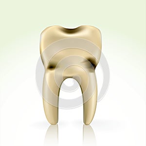 Unhealthy, yellow cavity tooth