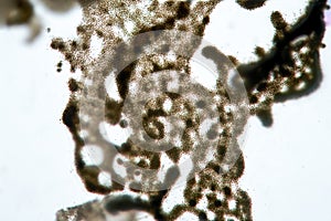 Unicellular algae Microcystis cyanobacteria by microscope. Cause of freshwater algal pollution