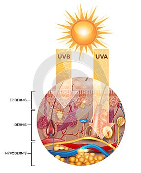 Unprotected skin without sunscreen lotion