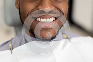 Unrecognizable Black Man Widely Smiling With His Perfect Healthy White Teeth, Closeup