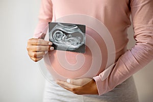 Unrecognizable black pregnant lady demonstrating her baby sonography photo