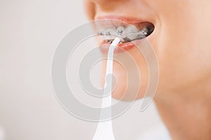 Unrecognizable woman uses an irrigator to clean dental braces.