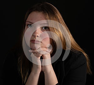 Unretouched teen girl with blemishes and dry skin