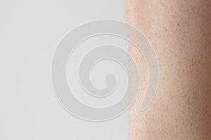 unshaven, hairy legs of a woman before hair removal. concept of smooth skin without hair, spa concept