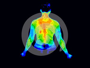 Upper body thermography photo