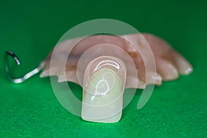 Upper jaw prosthesis