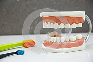 Upper and lower jaw dental model with toothbrushes