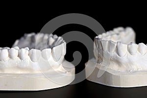 Upper and lower teeth made of plaster
