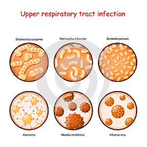Respiratory infection. Bacteria and viruses