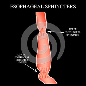 Upper sphincter of esophagus. Lower cardiac esophageal sphincter. Infographics. Vector illustration on black background. photo