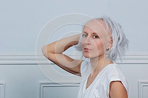 Upset hairless person in light-colored clothing take of her wig