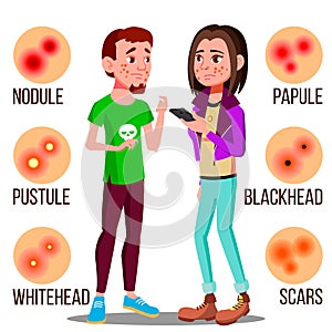 Upset Teenager With Pimples On The Face Vector. Isolated Illustration
