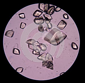 Uric acid in urine sediment photo