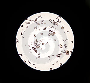 Uric acid in urine sediment.Uric acid is made from the natural b