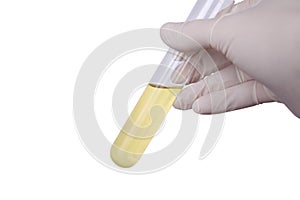 Urin sample photo
