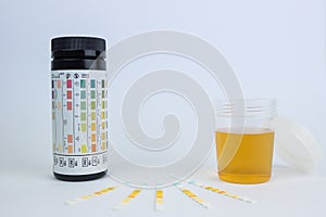 Urin test stripes, Urinanalyses, glucose and protein test photo
