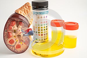 Urinalysis, Kidney model and urine cup with reagent strip pH paper test and comparison chart in laboratory